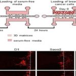 Mô hình in vitro giúp giải thích lý do ung thư vú di căn đến xương